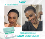 Saam 50g Renewal Face Cream For Melasma And Freckles Treatment 50g